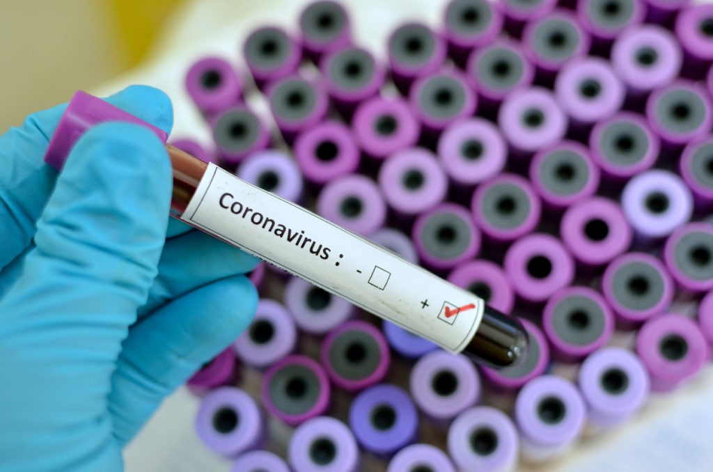 الصراع الأمريكي الألماني بشأن تطعيم فيروس كورونا