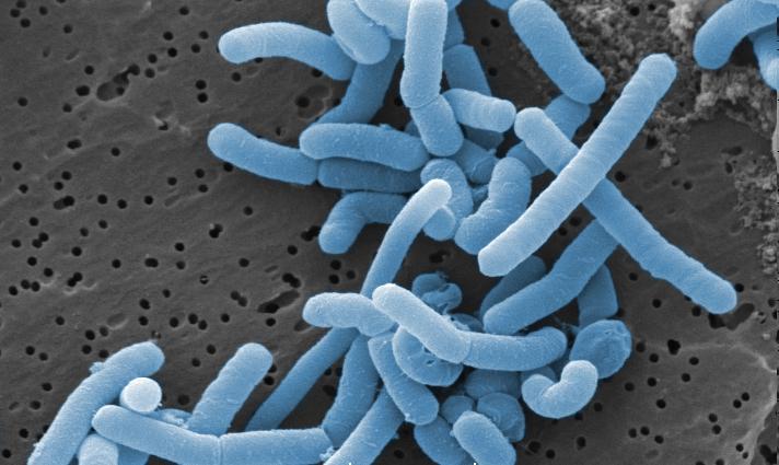 نوع من بكتيريا اللاكتوباسيلس تحت الميكروسكوب، تساعدك البكتيريا في علاج الجيوب الأنفية وحماية الأنف من الأمراض.